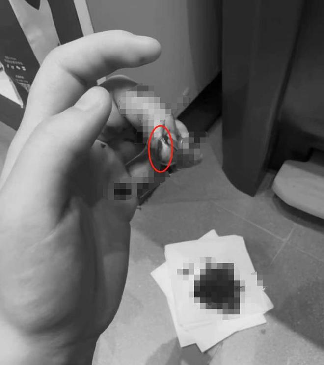 江苏女子上班切破手竟向老板索赔5000未谈妥直接曝光店铺黑料(图3)